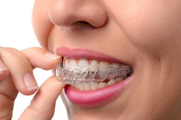 Advantages of Invisalign treatment at Holistic Dental Donvale